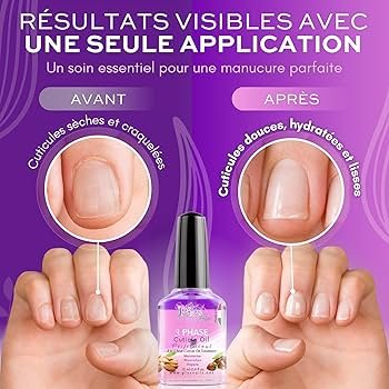 Soin Cuticule Ongle